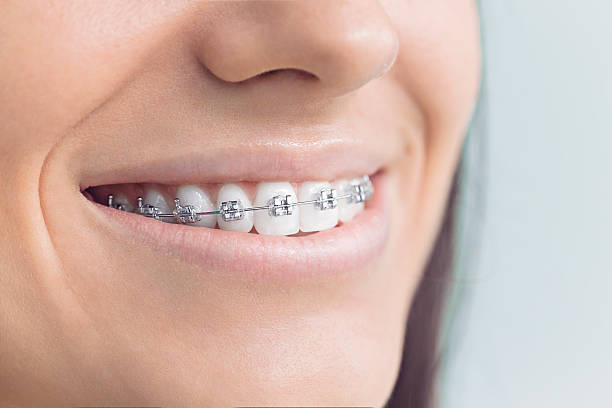 Best Invisalign and Clear Aligners  in Sibley, LA